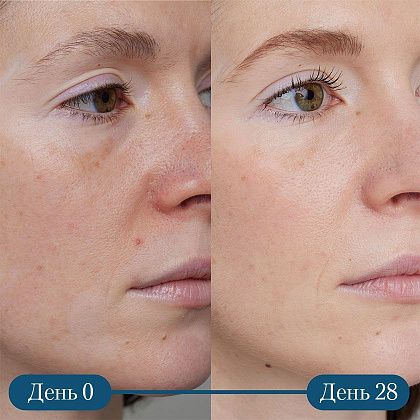 ELEMIS Dynamic Resurfacing Super-C Serum