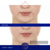 Augustinus Bader The Retinol Serum 15 ml.
