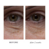ELEMIS Peptide4 Eye Recovery Cream